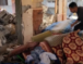 طبيب بريطاني: مستشفيات غزة تعمل في ظروف أشبه بـ”العصور الوسطى”